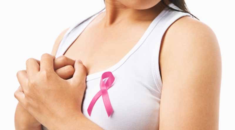 20181019 brown1 Prevención cáncer de mama