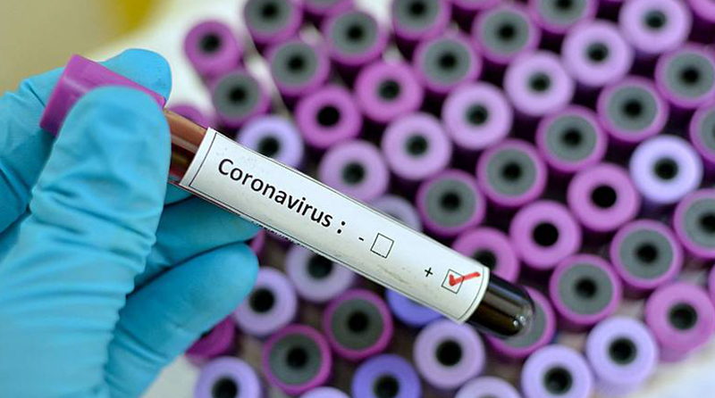 2020 04 19 casos de coronavirus 2222 Berazateguiv coronavirus