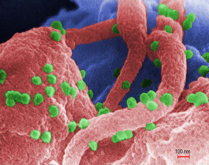 viriones vih infectando celulas humanas VIH
