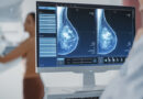 «Más del 70% de las mujeres con cáncer de mama no tienen antecedentes familiares»