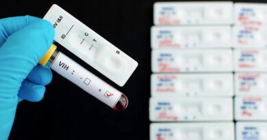 20250104 HIV VIH SIDA ANALISIS TEST