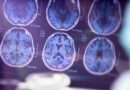Riesgo de Alzheimer: Estudio advierte que saberlo baja el entusiasmo por hábitos saludables, pese a no dañar la salud mental Riesgo de Alzheimer: Estudio advierte que saberlo baja el entusiasmo por hábitos saludables, pese a no dañar la salud mental