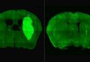 Un estudio del CONICET logra frenar un tipo de cáncer cerebral en modelos preclínicos Un estudio del CONICET logra frenar un tipo de cáncer cerebral en modelos preclínicos