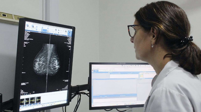 La PBA comenzará a indicar la mamografía a los 40 años 1 Mamografia