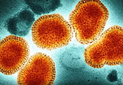 Alerta por Influenza H3N2: qué recomiendan los profesionales ante el brote