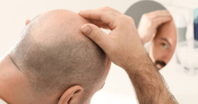 Medicina china: una raíz milenaria surge como esperanza contra la alopecia Medicina china: una raíz milenaria surge como esperanza contra la alopecia