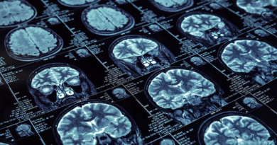 20220307 ALZHEIMER Recomiendan restringir el acceso en celulares a aplicaciones para niños