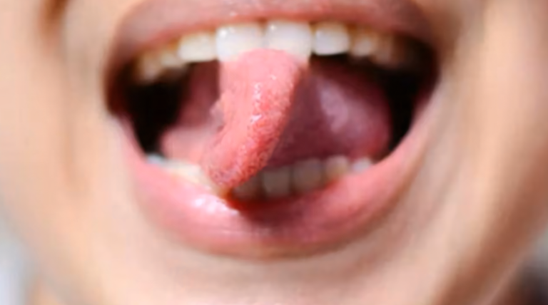 20260325 LENGUA girar la lengua 180º