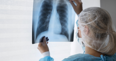 20260825 tuberculosis rx