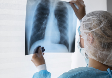 Tuberculosis en Argentina: suba de casos y alerta sanitaria